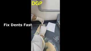 ボディフィラー